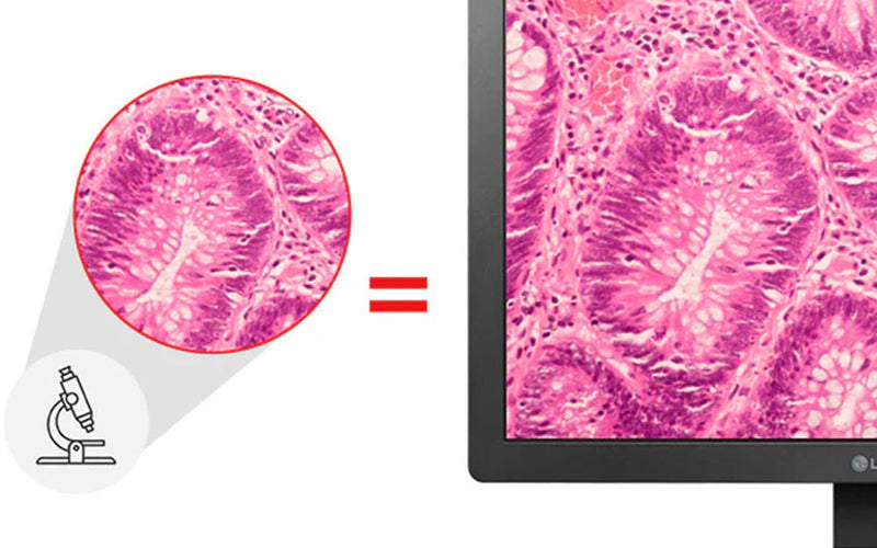 Pathologie-modus – Net als door een microscoop kijken