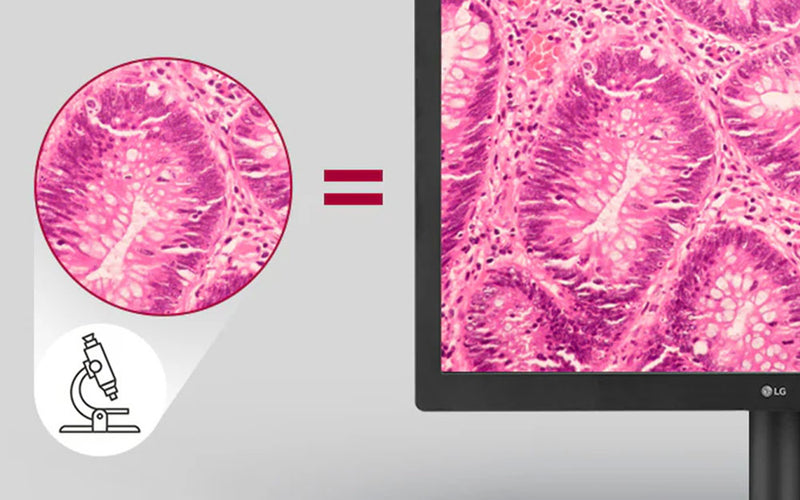 La Modalità Patologia Fornisce Chiarezza Proprio Come Guardare Attraverso un Microscopio