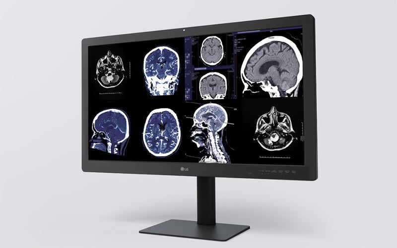 LG Monitor Diagnostico da 31,5