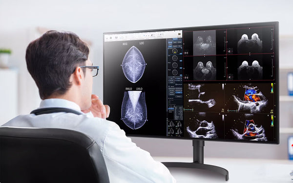 31.5" 8MP IPS Display – Accurate Imaging from Any Angle
