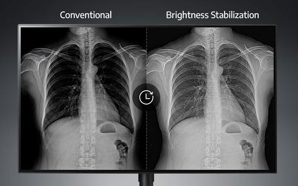 Brightness Stabilization – Consistent Visual Performance Over Time