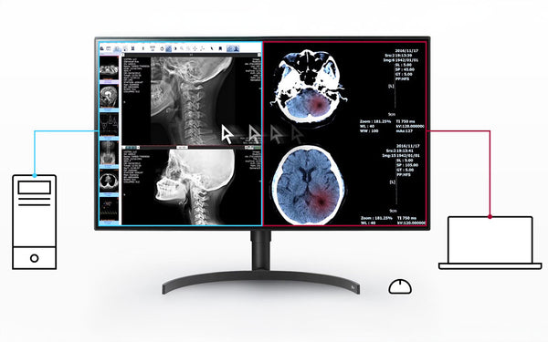 PBP & Dual Controller – Multiple Signals on One Screen