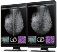 Mammography Displays