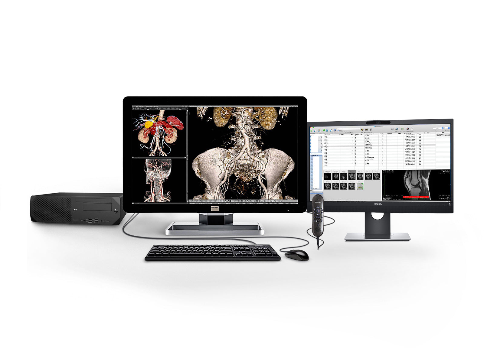 Complete PACS General Radiology Station | Barco Display HP Workstation