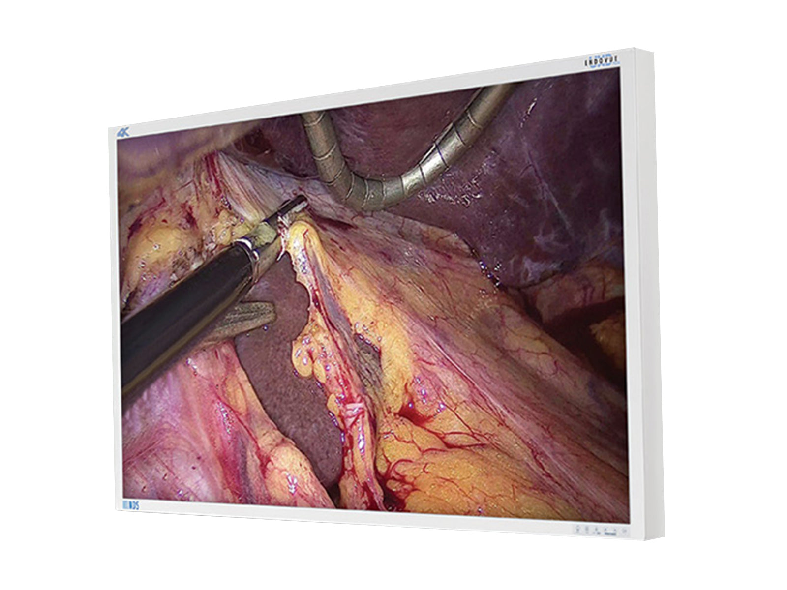 NDS EndoVue Plus 55" BC-WK55-A1B20 4K Surgical Endoscopy Medical Display Monitor