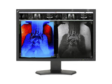 NEC MultiSync MD242C2 2.3MP Moniteur d'affichage d'examen clinique LCD couleur 24 "(MD242C2)