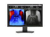 NEC MultiSync MD242C2 2.3MP 24-Zoll-Farb-LCD-Monitor für klinische Untersuchungen (MD242C2)