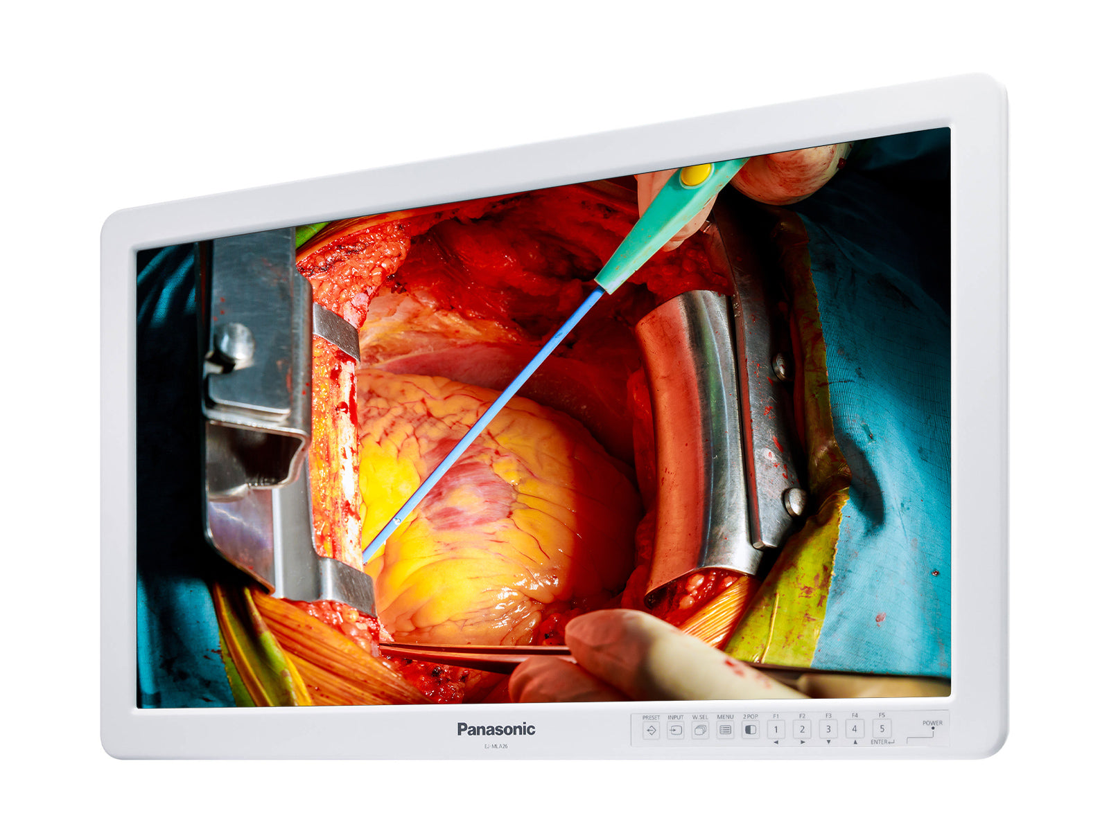 Panasonic EJ-MLA26U 26” 8MP WUXGA Color Surgical Medical Display Monitor (EJ-MLA26U)