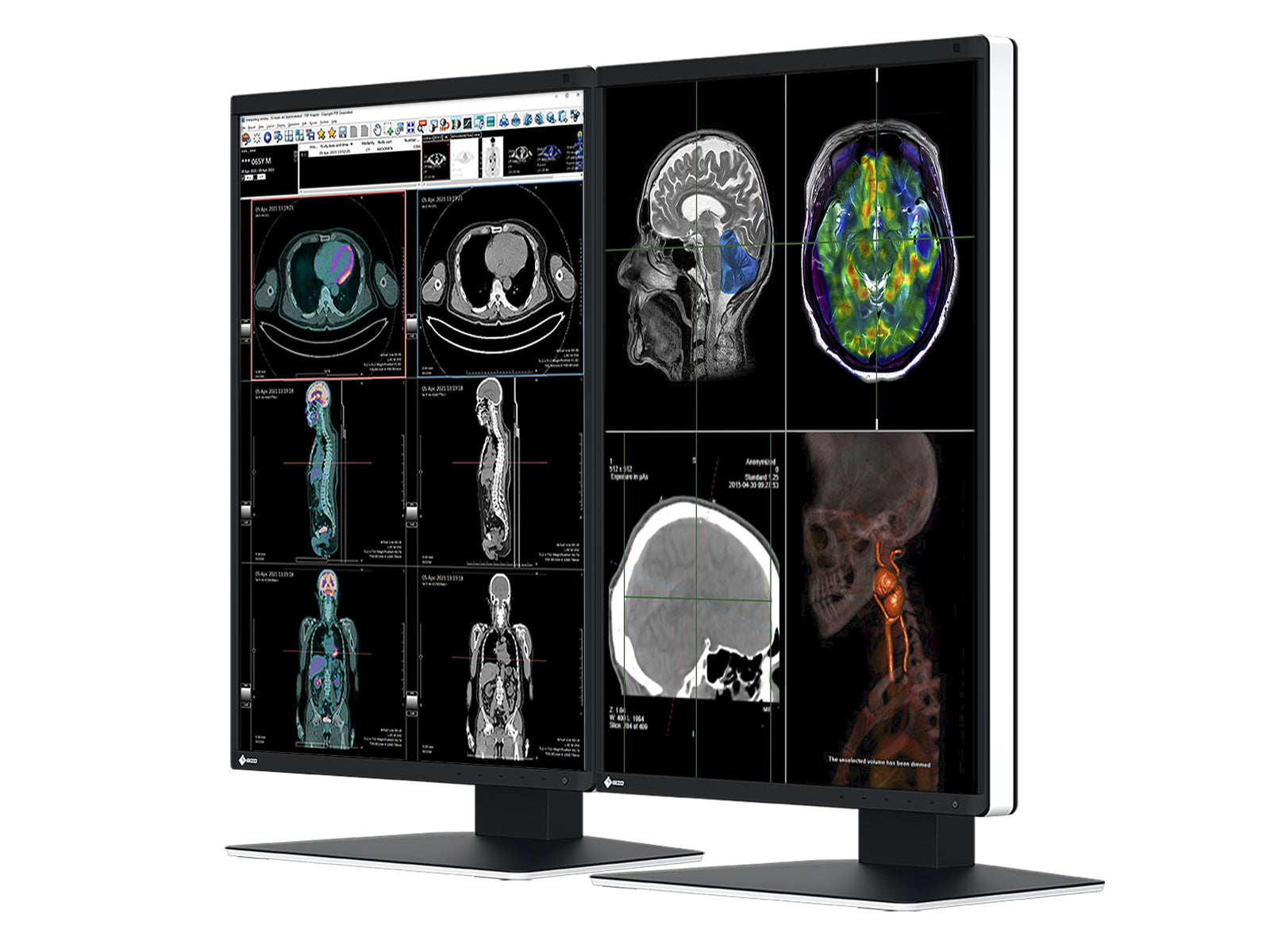 Dual Eizo RadiForce RX370 3MP 21" Color LED General Radiology Diagnostic PACS Display (RX370)