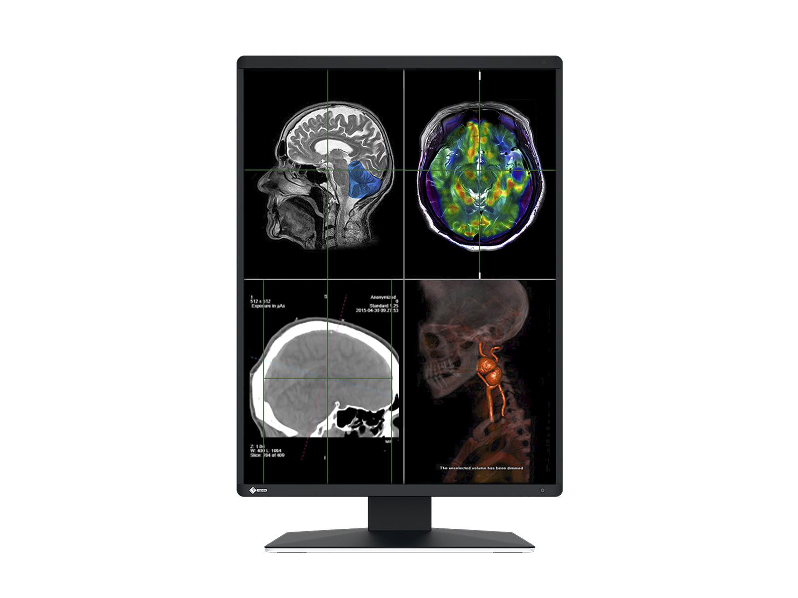 Eizo RadiForce RX370 3MP 21" Color LED General Radiology Diagnostic PACS Display (RX370) Monitors.com 