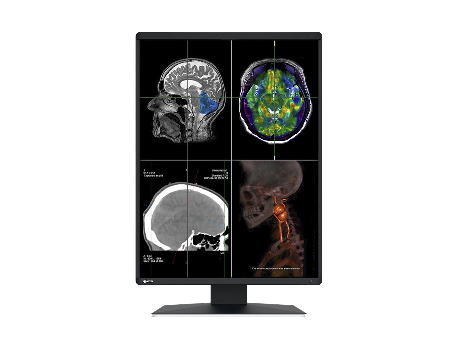 Eizo RadiForce RX370 3MP 21" Kleuren LED Algemeen Radiologie Diagnostisch PACS-display (RX370)