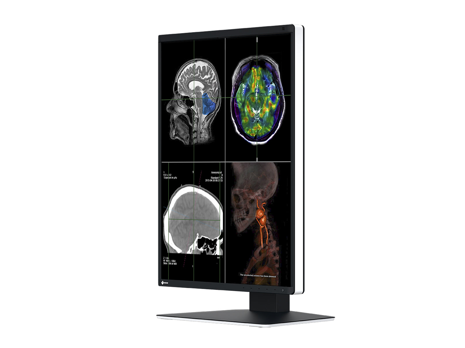 Eizo RadiForce RX370 3MP 21" Color LED General Radiology Diagnostic PACS Display (RX370)