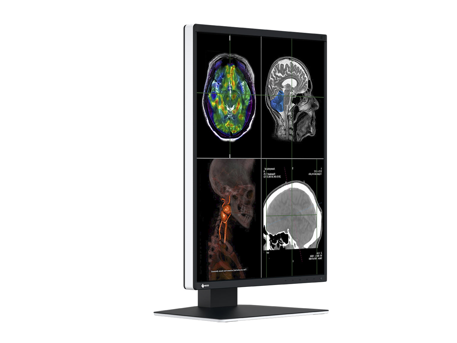 Eizo RadiForce RX370 3MP 21" Color LED General Radiology Diagnostic PACS Display (RX370) Monitors.com 