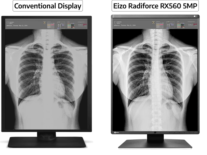 Eizo RadiForce RX560 5MP Color LED 3D-DBT Mammo Display (RX560-BK)