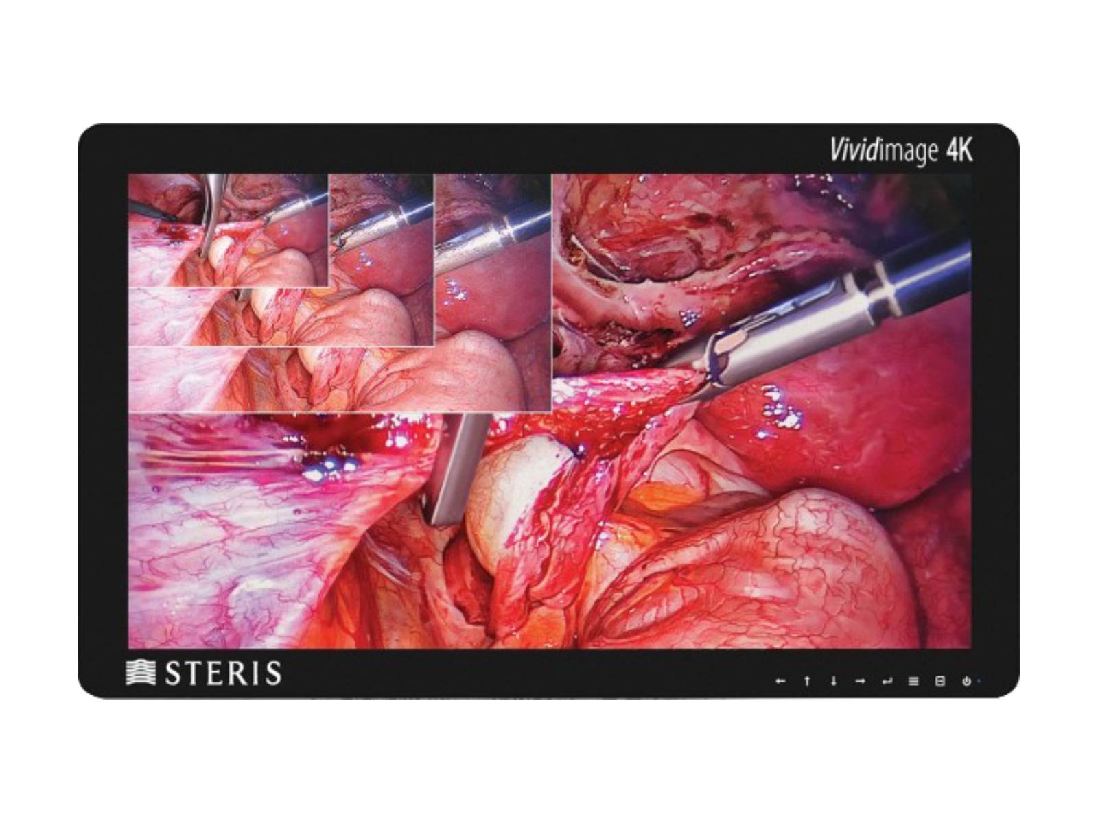 Steris Vividimage RLM314KC 31" 8MP 4K LED Surgical Display Monitor (STERIS-31-4K-R)
