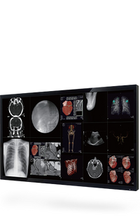 Surgical Displays