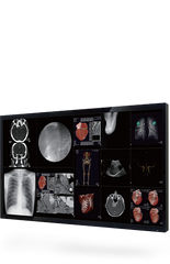 Surgical Displays