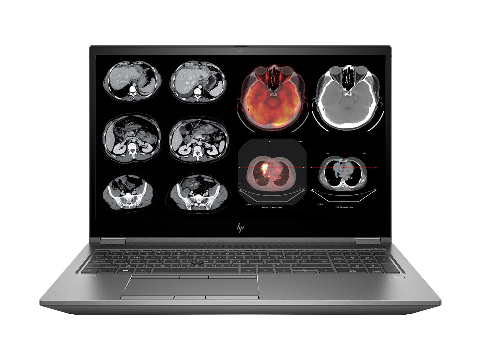 HP ZBook Fury 15 G8 Mobile Radiology Workstation | 15.6" 4K LED | Core i7-11850H @ 4.80GHz | 8-Core | 64GB DDR4 | 1TB NVMe SSD | Quadro RTX A3000 8GB | Win11 Pro Monitors.com 