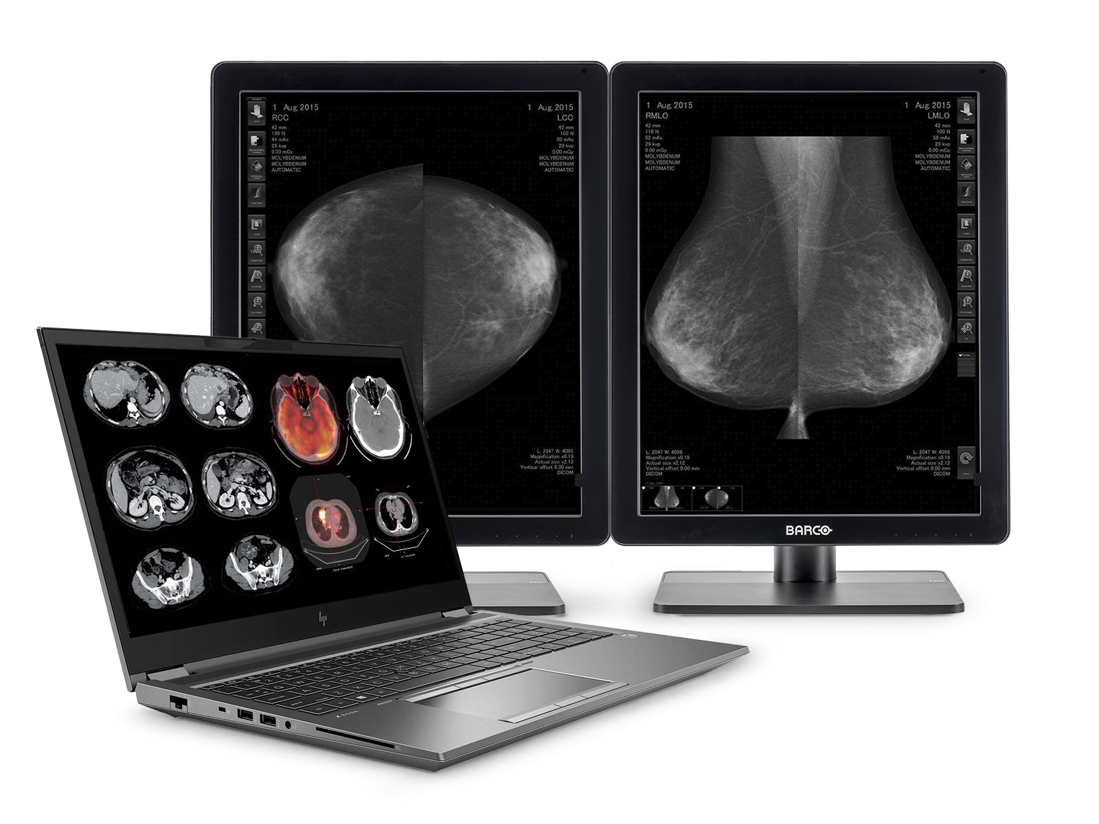 HP ZBook Fury 17 G8 Mobile Radiology Workstation | 17.3" FHD DICOM Calibrated | Core i9-11950H @ 5.0GHz | 128GB DDR4 | 1TB NVMe SSD | RTX A5000 16GB | Win10-11 Pro Monitors.com 