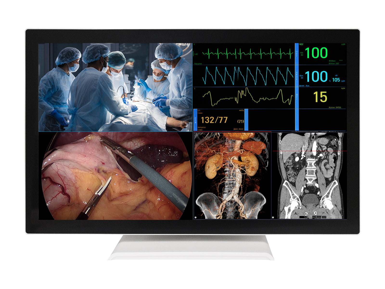 Barco AMM 215WTTP 21.5” Full HD Touchscreen Color Clinical Review Display Monitor