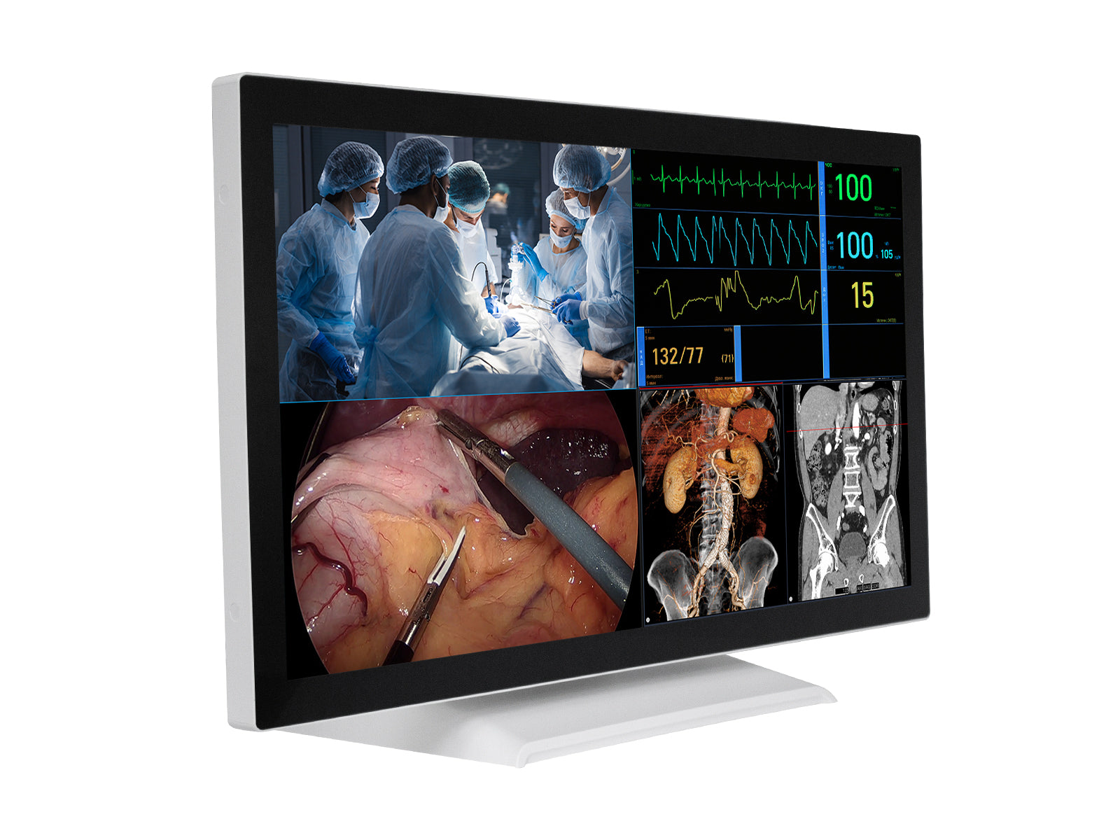 Barco AMM 215WTTP 21.5” Full HD Touchscreen Color Clinical Review Display Monitor