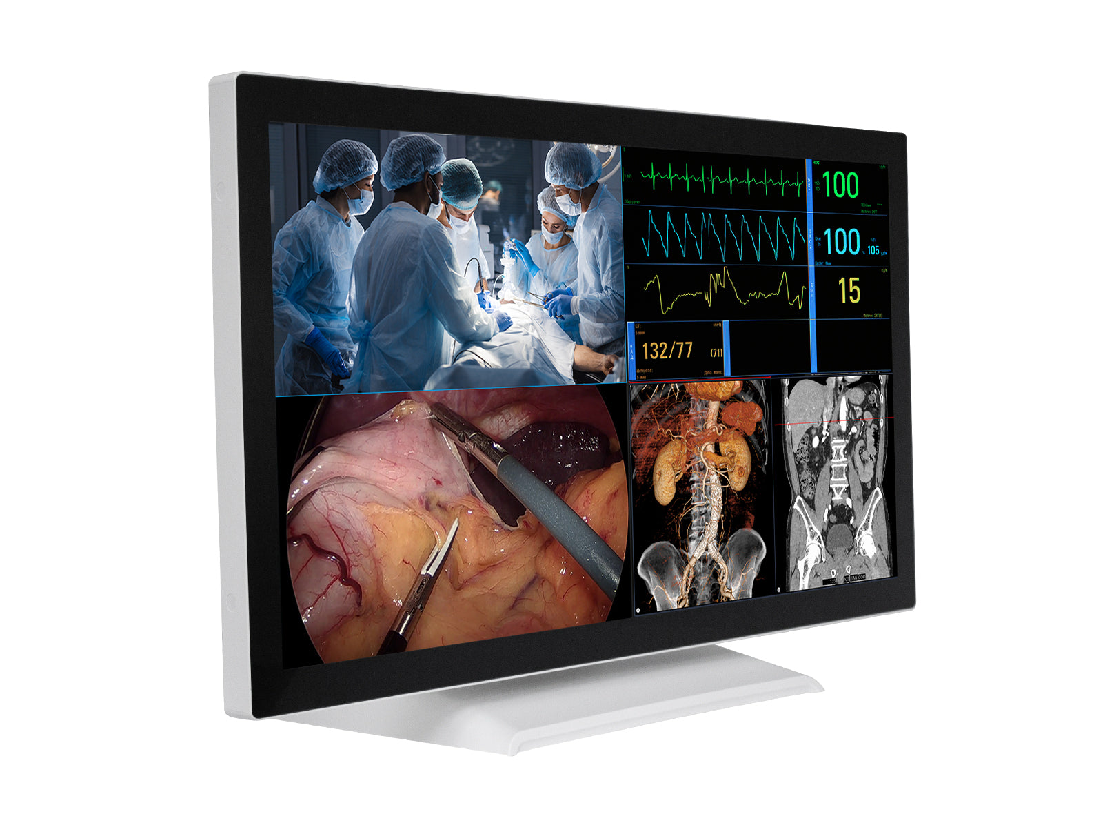 Barco AMM 215WTTP 21.5” Full HD Touchscreen Color Clinical Review Display Monitor Monitors.com 