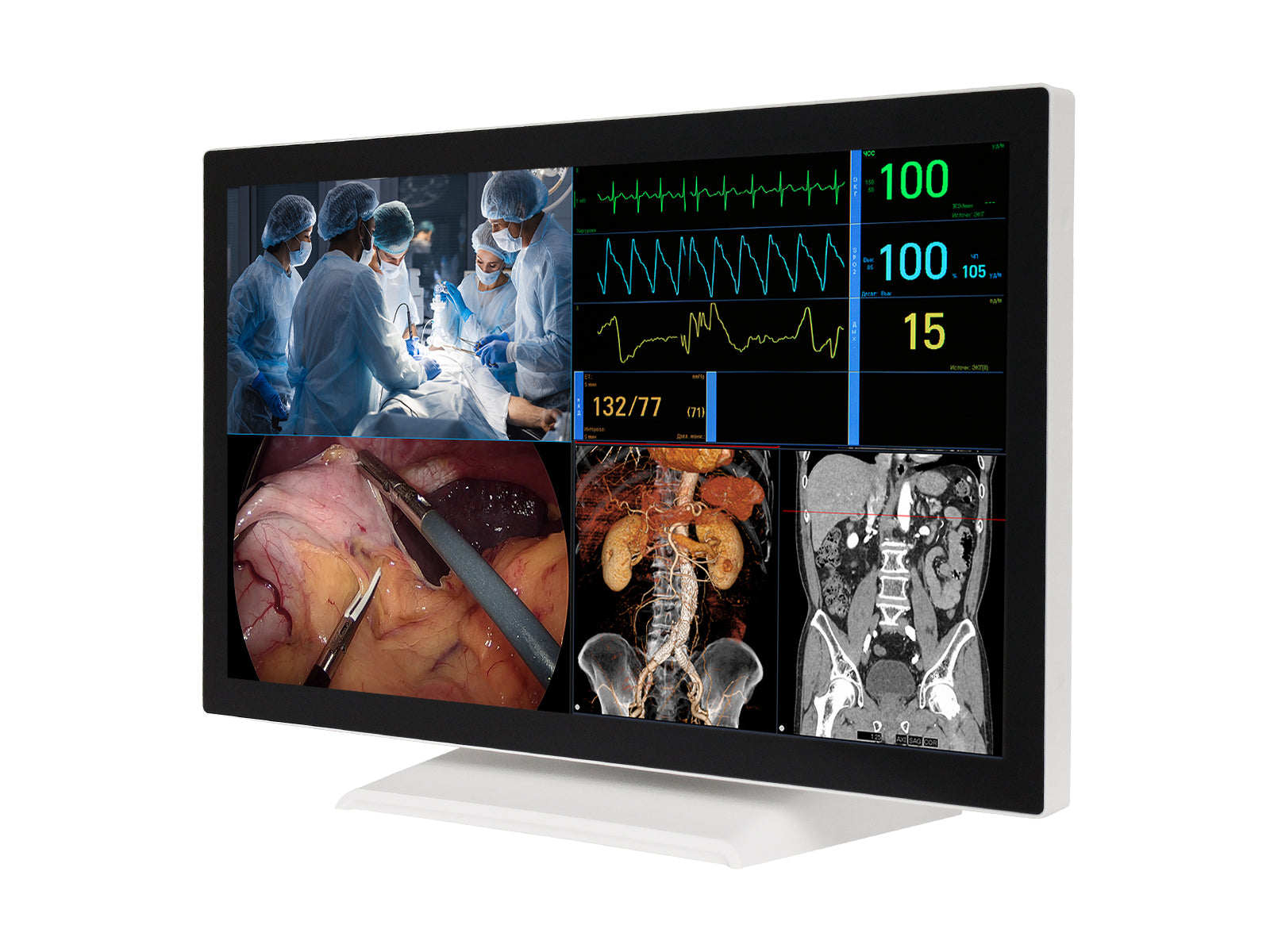 Barco AMM 215WTTP 21.5” Full HD Touchscreen Color Clinical Review Display Monitor Monitors.com 