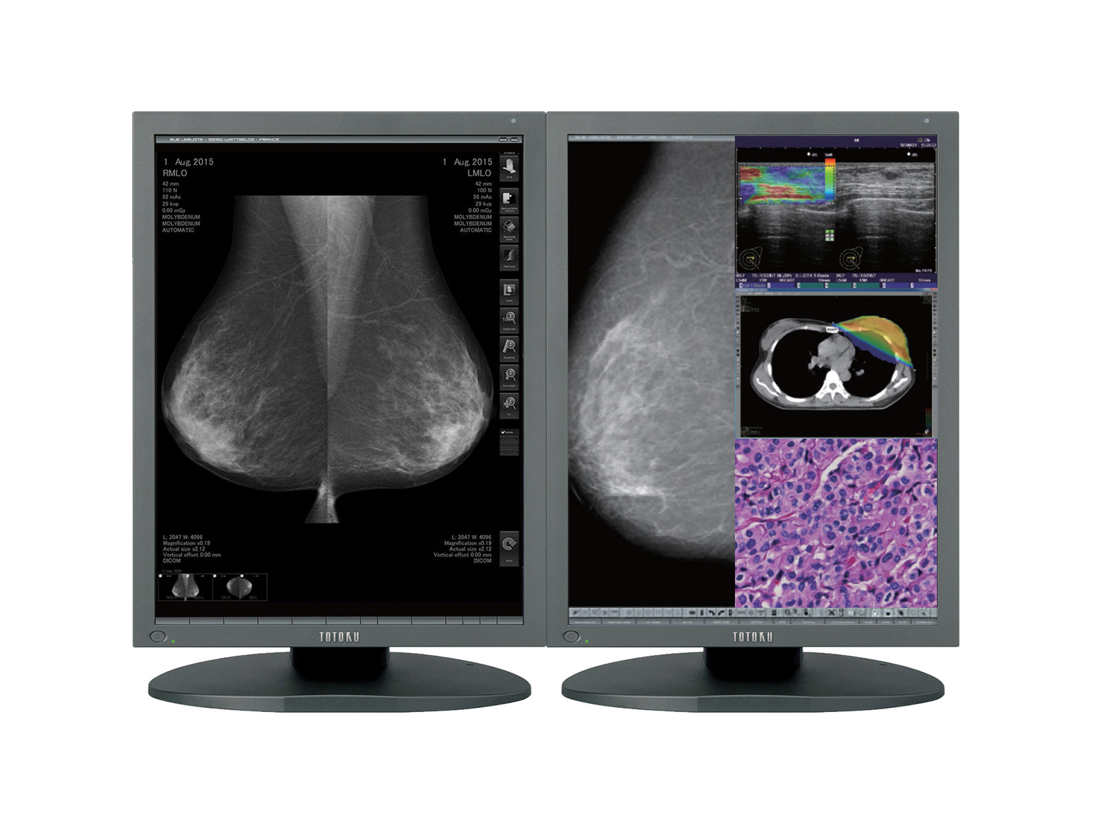 Écran d'imagerie mammaire Mammo 550D-DBT LED couleur 2MP 5" JVC Totoku CCL21i3 (CCL550i2) Monitors.com