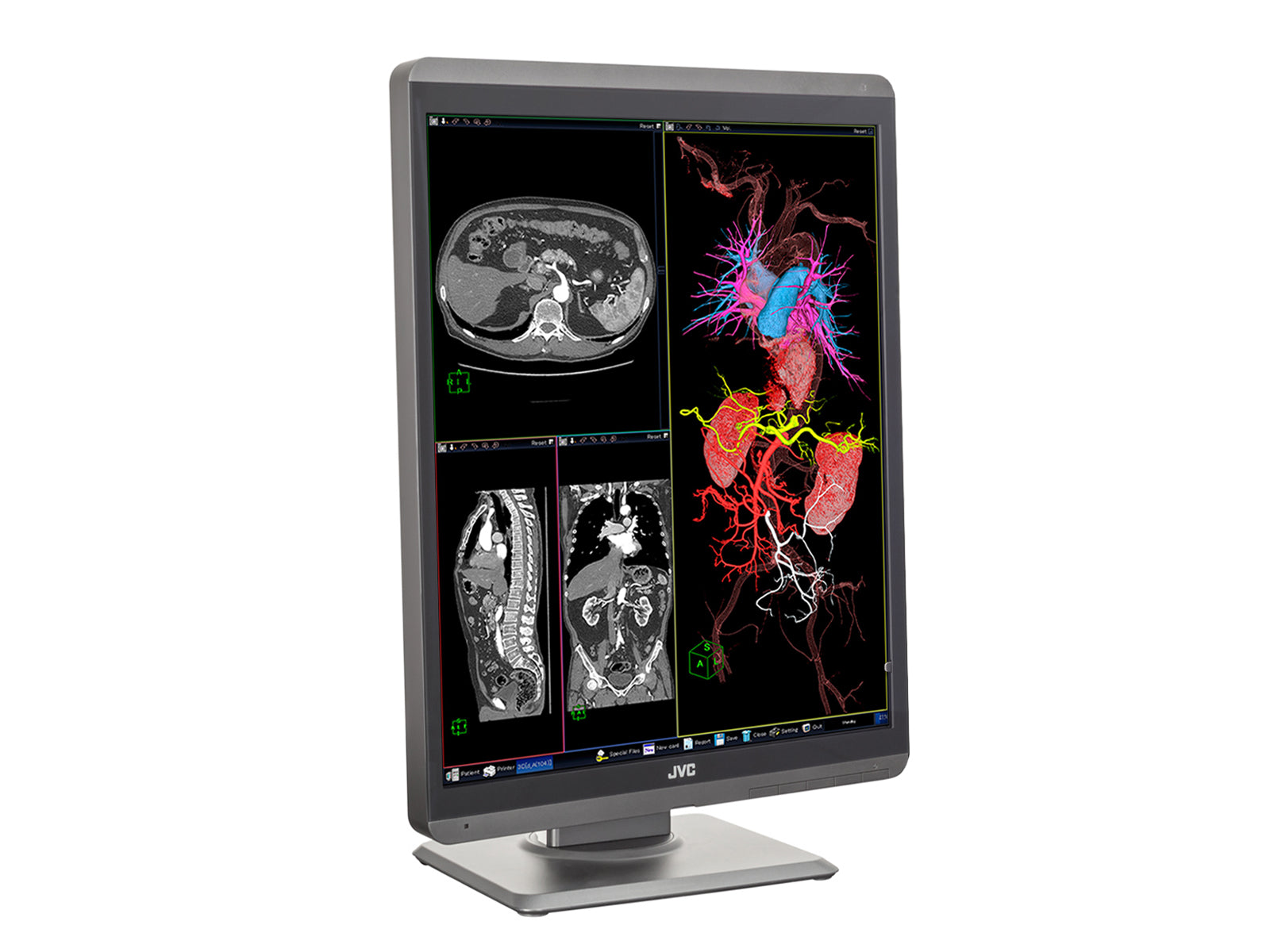 JVC Totoku CL-R211 2MP 21" Color Clinical Review Display Monitor (CL-R211) Monitors.com 