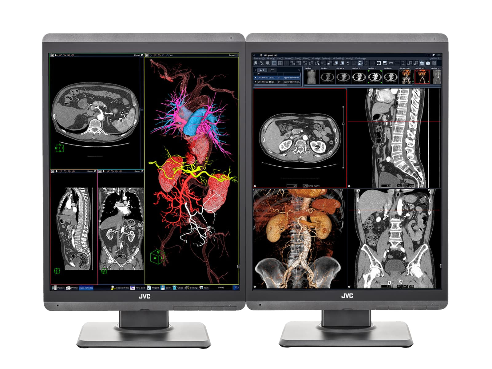 JVC Totoku CL-S300 Monitores de pantalla de diagnóstico de radiología general LED a color de 3MP y 21" (CL-S300)