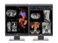 JVC Totoku CL-S300 3MP 21 "Color LED General Radiología Monitores de pantalla de diagnóstico (CL-S300)