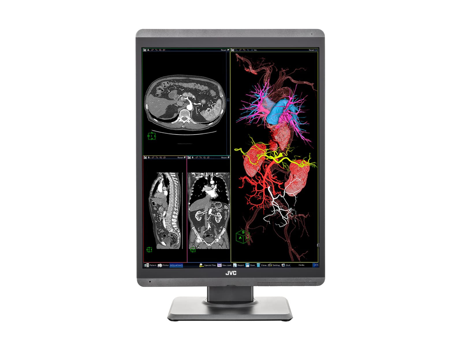 JVC Totoku CL-S300 3MP 21 "Renkli LED Genel Radyoloji Teşhis Ekran Monitörleri (CL-S300)