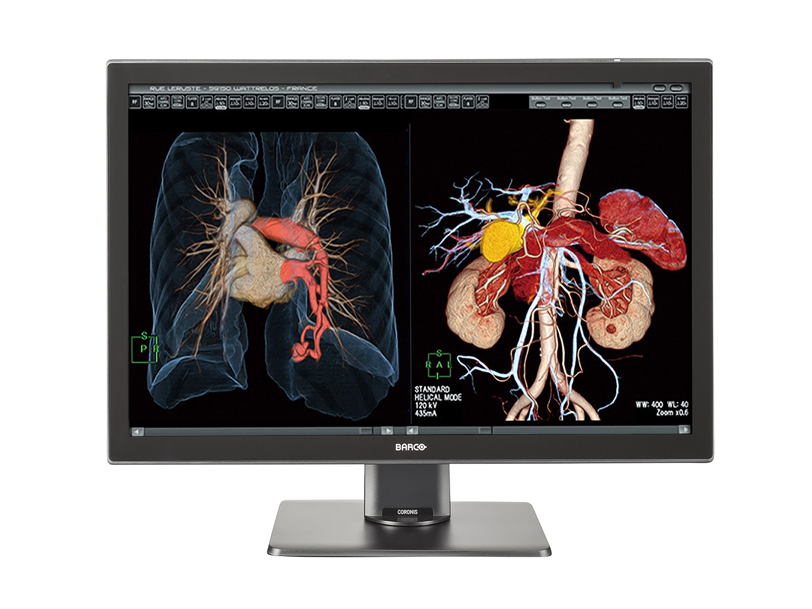 Barco Coronis Fusion MDCC-4430 4MP 30" Color LED Medical Diagnostic PACS Display Monitors.com 