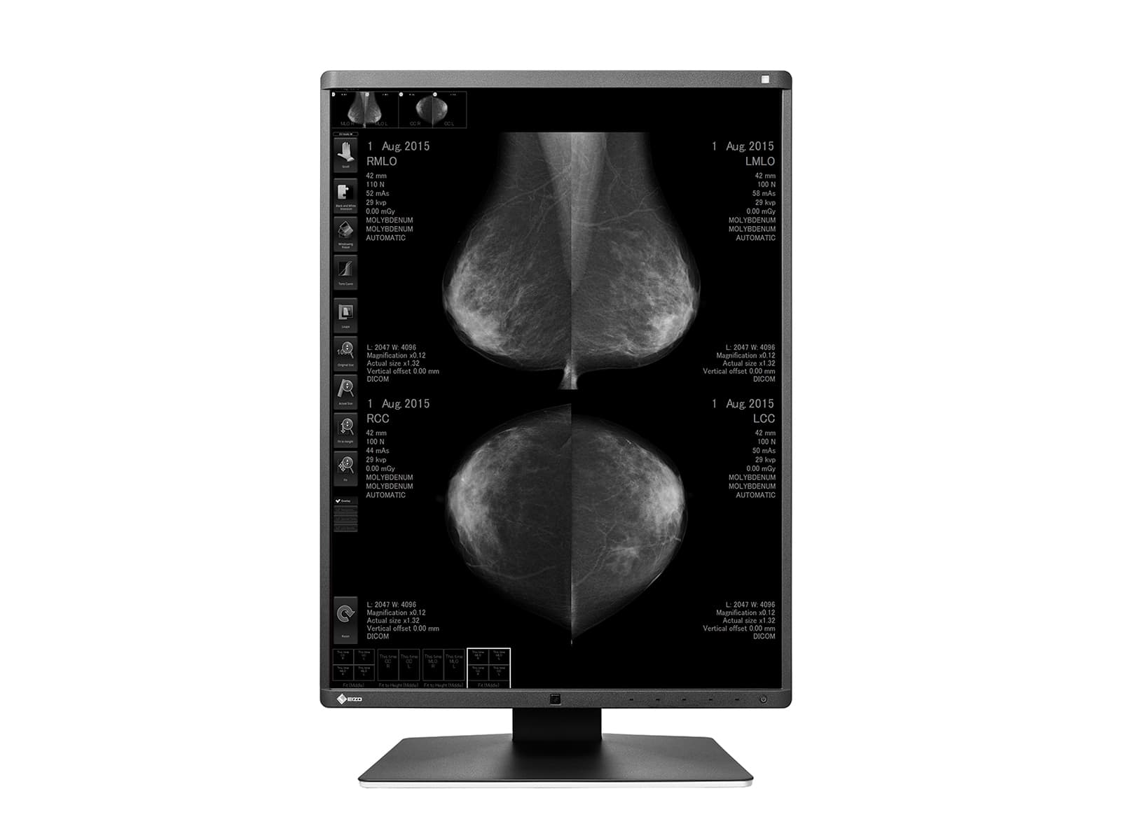 Eizo RadiForce GX560 5MP 21" LED Monitor de visualización de imágenes mamarias Mammo 3D-DBT en escala de grises (GX560-MD) Monitors.com