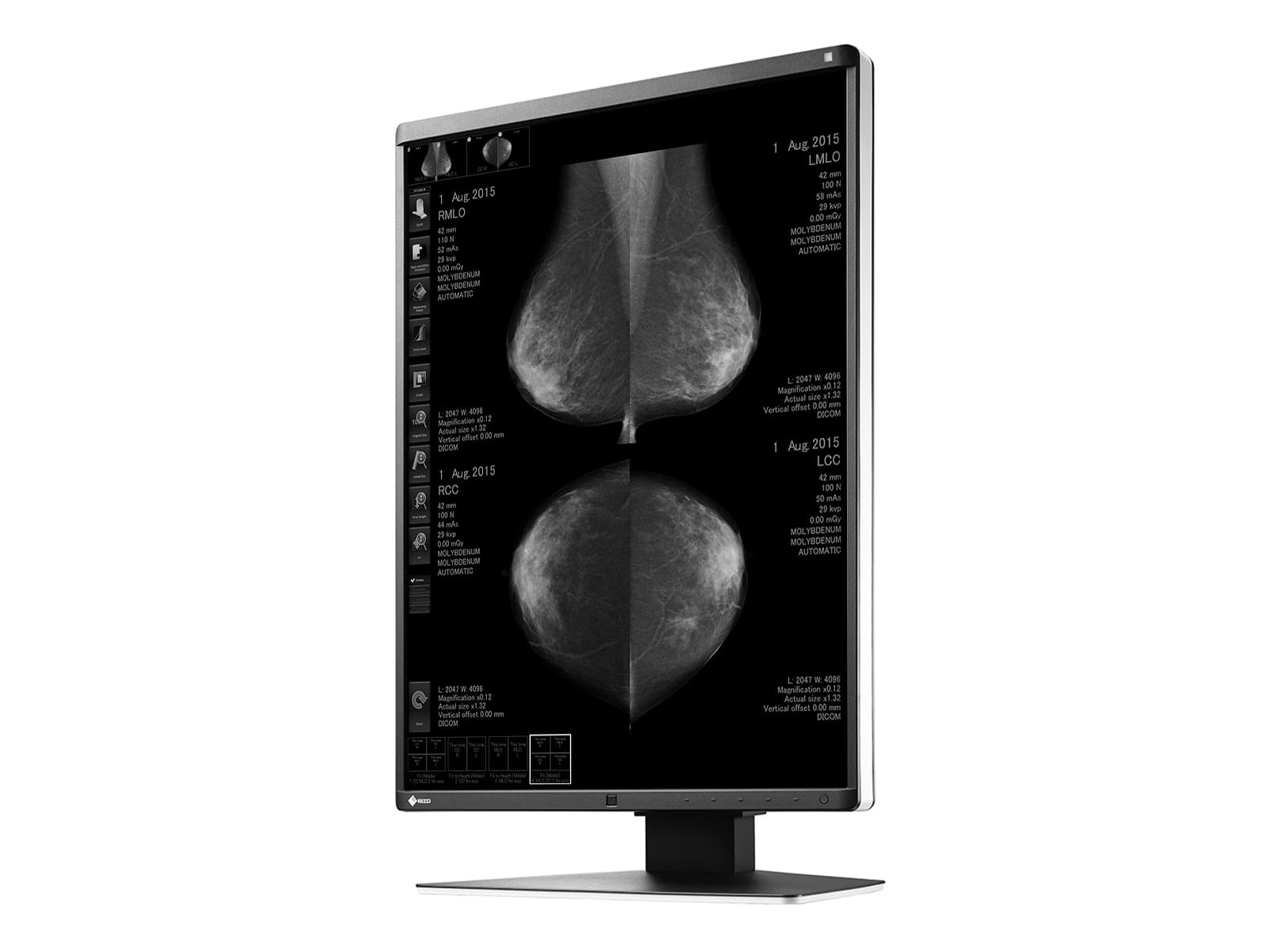 Eizo RadiForce GX560 5MP 21 インチ LED グレースケール Mammo 3D-DBT 乳房画像表示ディスプレイ モニター (GX560-MD) Monitors.com