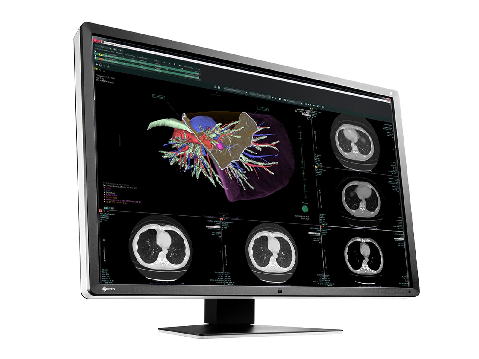 Eizo RadiForce RX660 6MP 30" Color LED General Radiology PACS Display (RX660-AR)