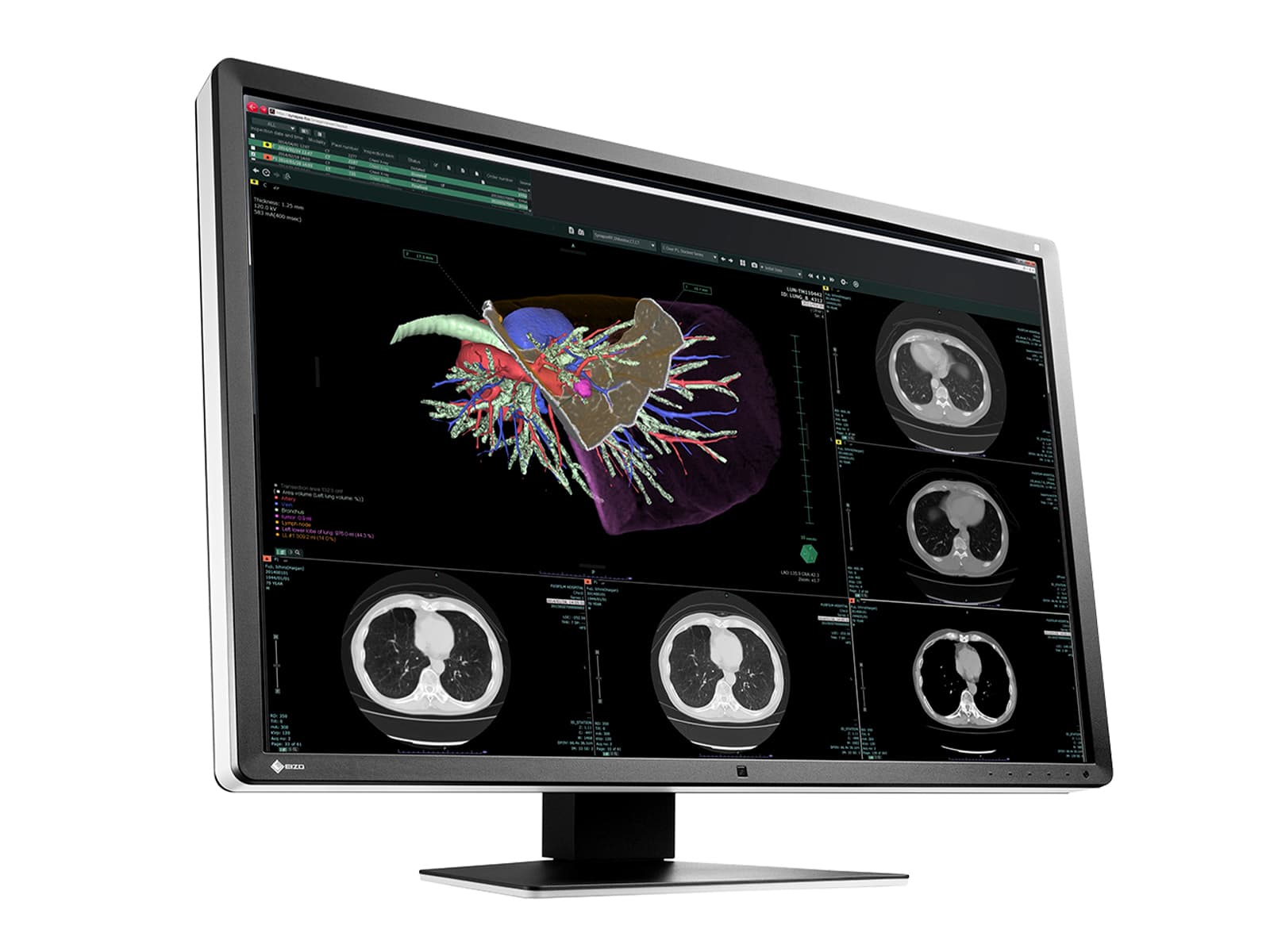 Eizo RadiForce RX660 6MP 30" Farb-LED-PACS-Display für allgemeine Radiologie (RX660-AR) Monitore.com