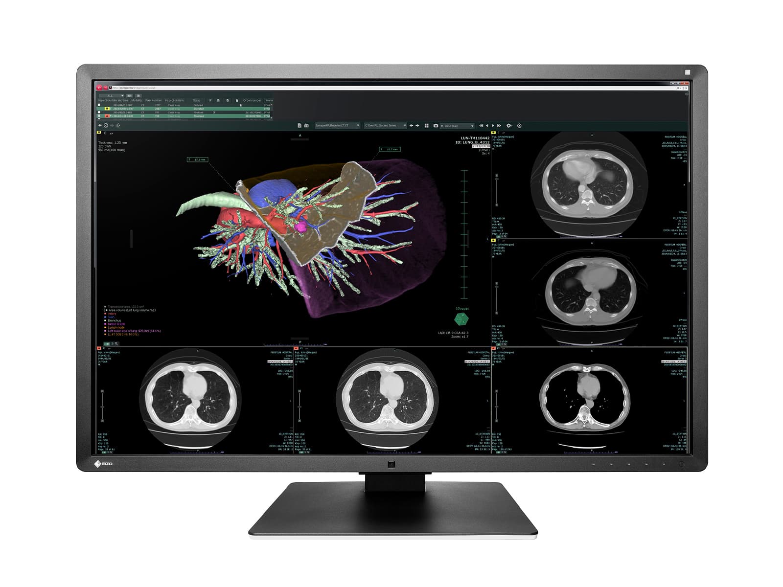 Eizo RadiForce RX660 6MP 30" Farb-LED-PACS-Display für allgemeine Radiologie (RX660-AR) Monitore.com