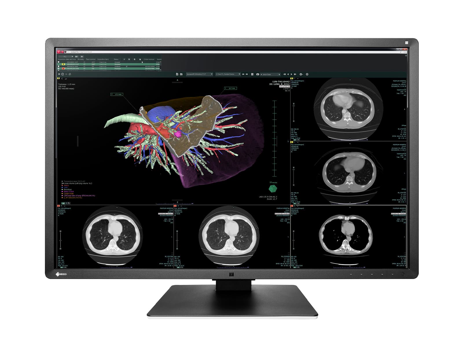 Eizo RadiForce RX660 6MP 30" 컬러 LED 일반 방사선학 PACS 디스플레이(RX660-AR) Monitors.com