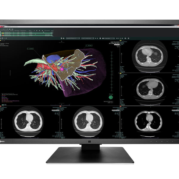 Eizo RadiForce RX660 6MP 30