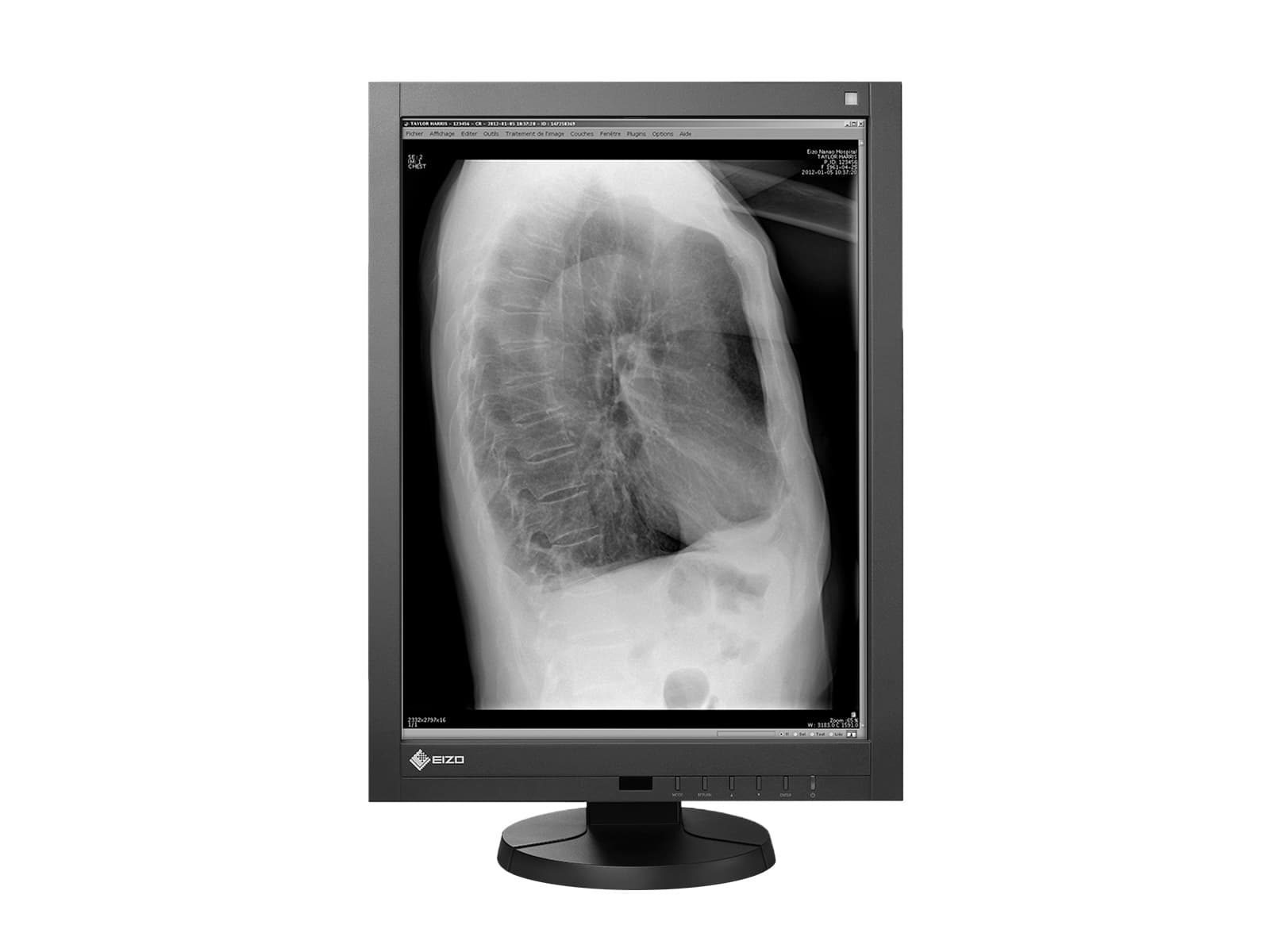 Eizo RadiForce GX340 3MP 21" Graustufen-LED-Monitor für allgemeine Radiologie-Diagnose (GX340-CL)