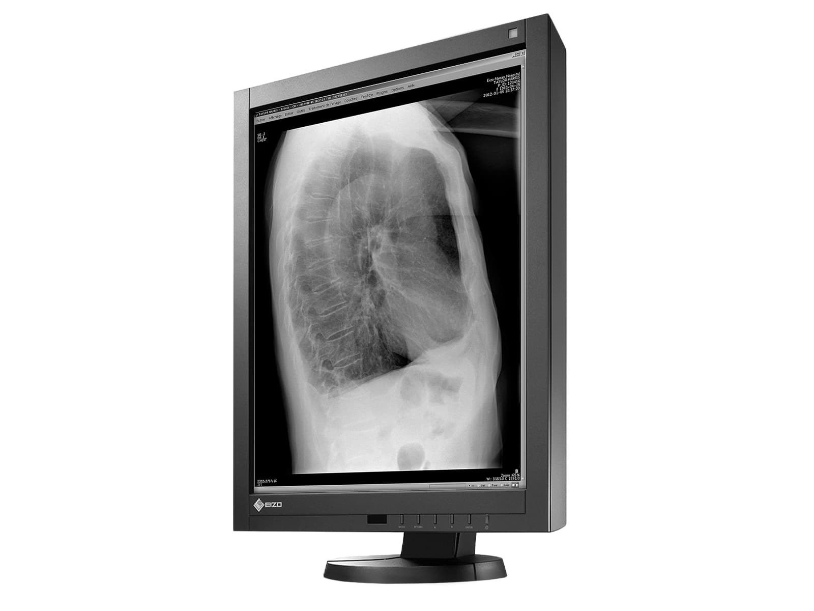 Eizo RadiForce GX340 3MP 21" Graustufen-LED-Monitor für allgemeine Radiologie-Diagnostik (GX340-CL) Monitors.com