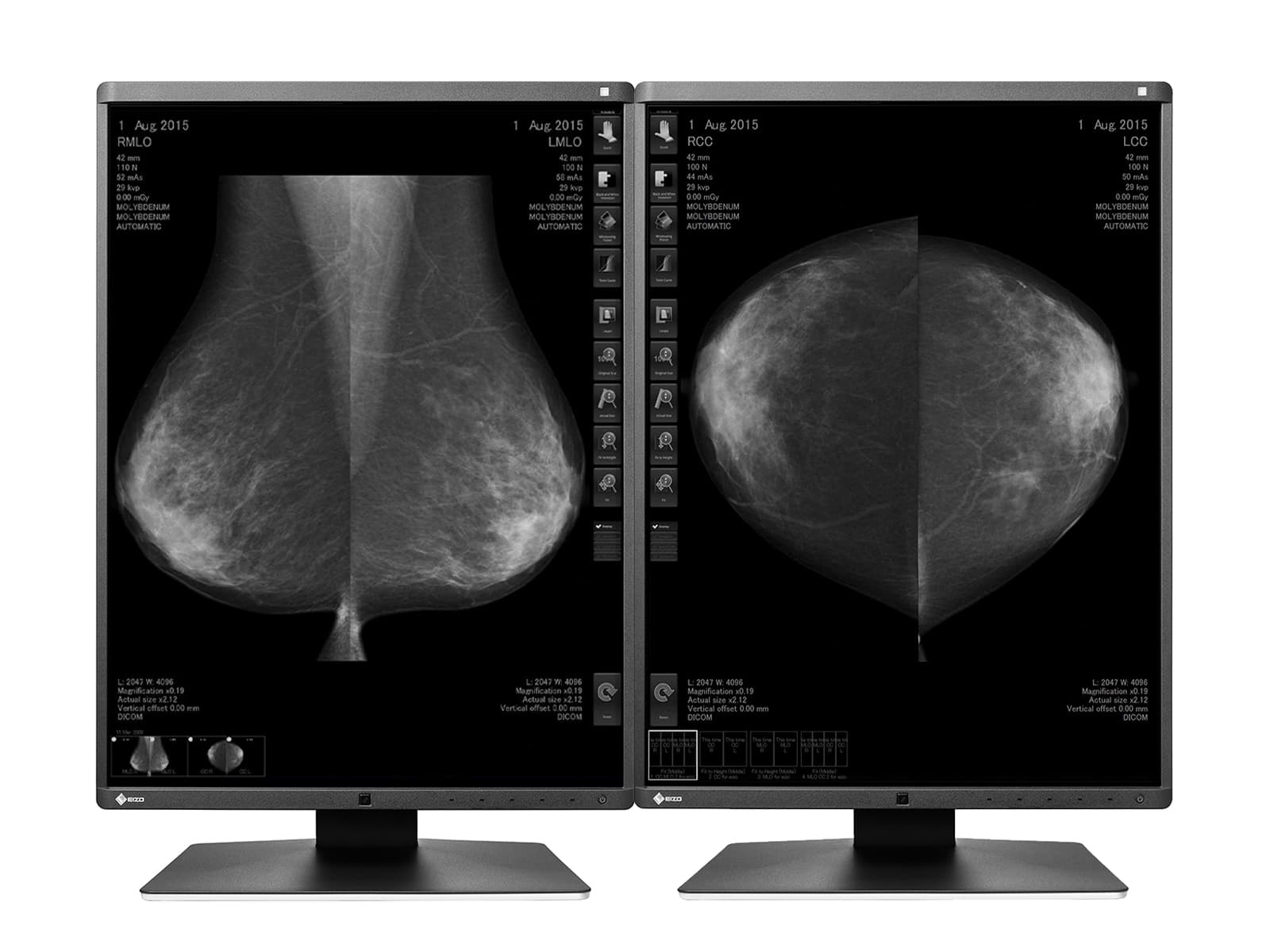 Eizo RadiForce GX550 5MP 21" LED Grayscale Mammo 3D-DBT Breast Imaging Display (GX550-BK) 