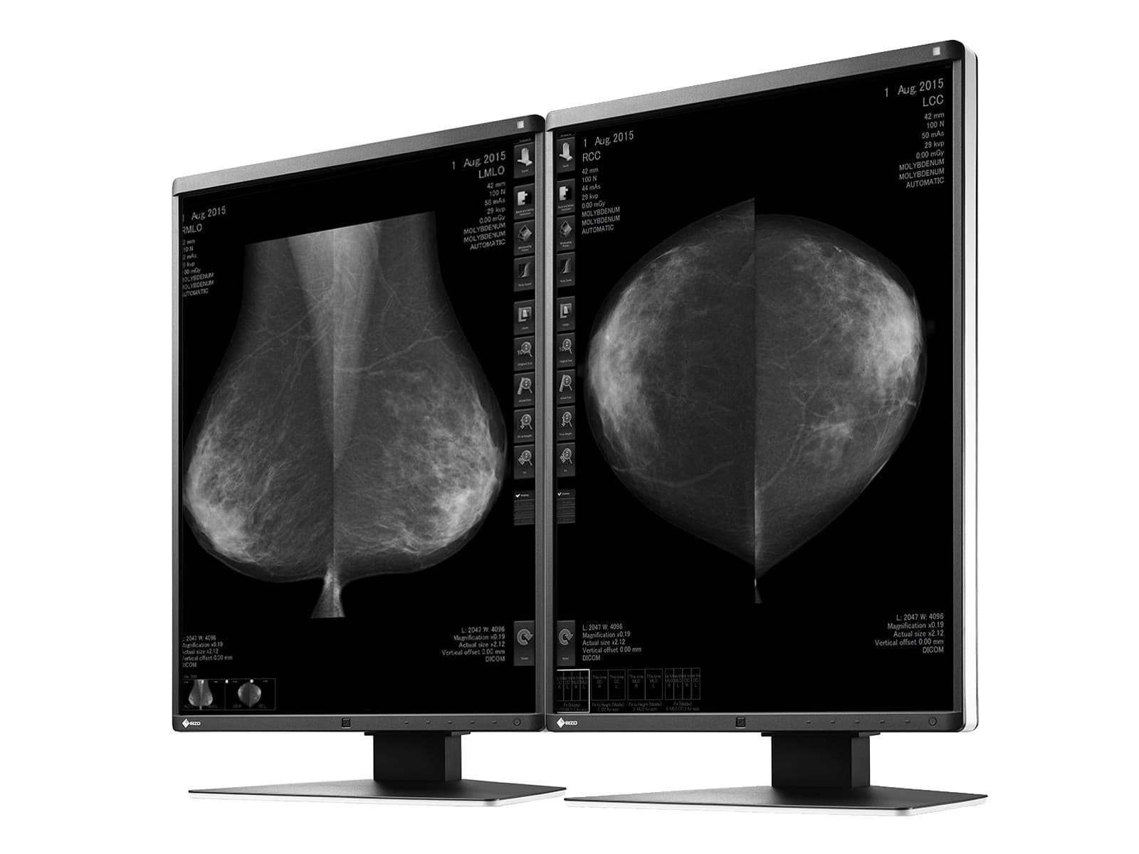 Eizo RadiForce GX550 5MP 21" LED Grayscale Mammo 3D-DBT Breast Imaging Display (GX550-BK)