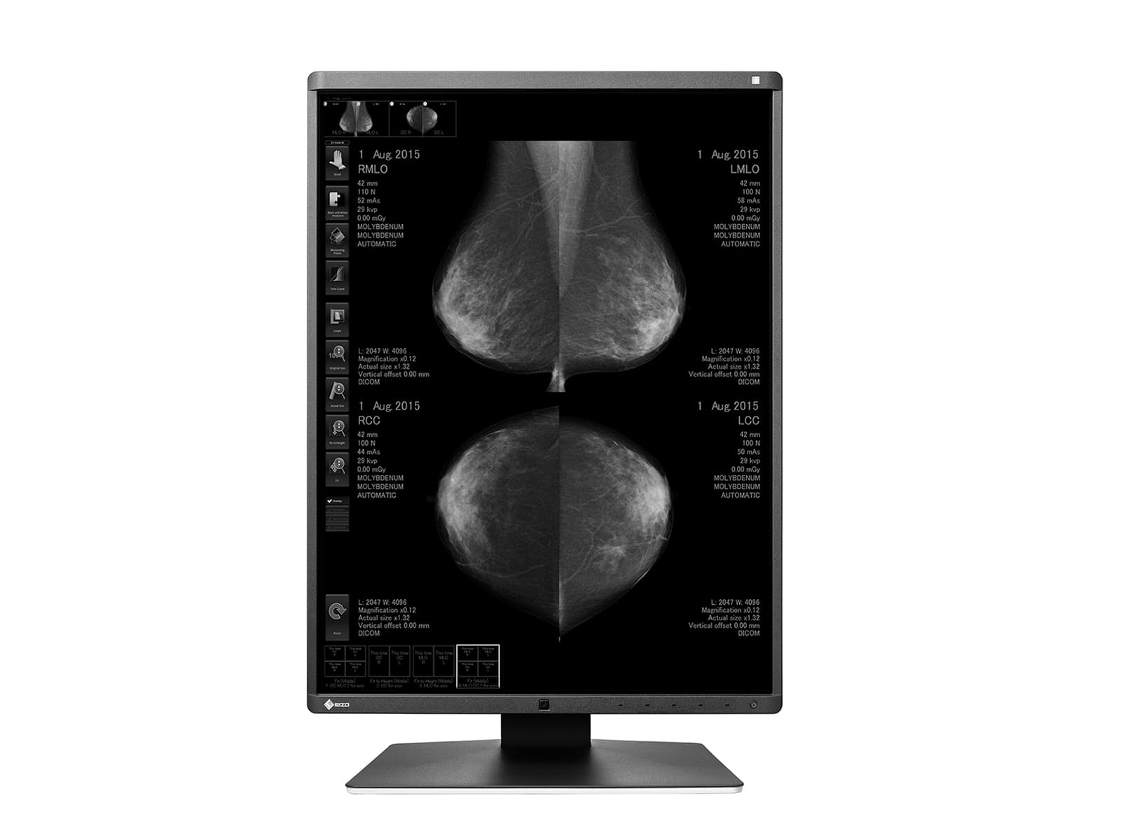 Eizo RadiForce GX550 5MP 21" LED Grayscale Mammo 3D-DBT Breast Imaging Display (GX550-BK)