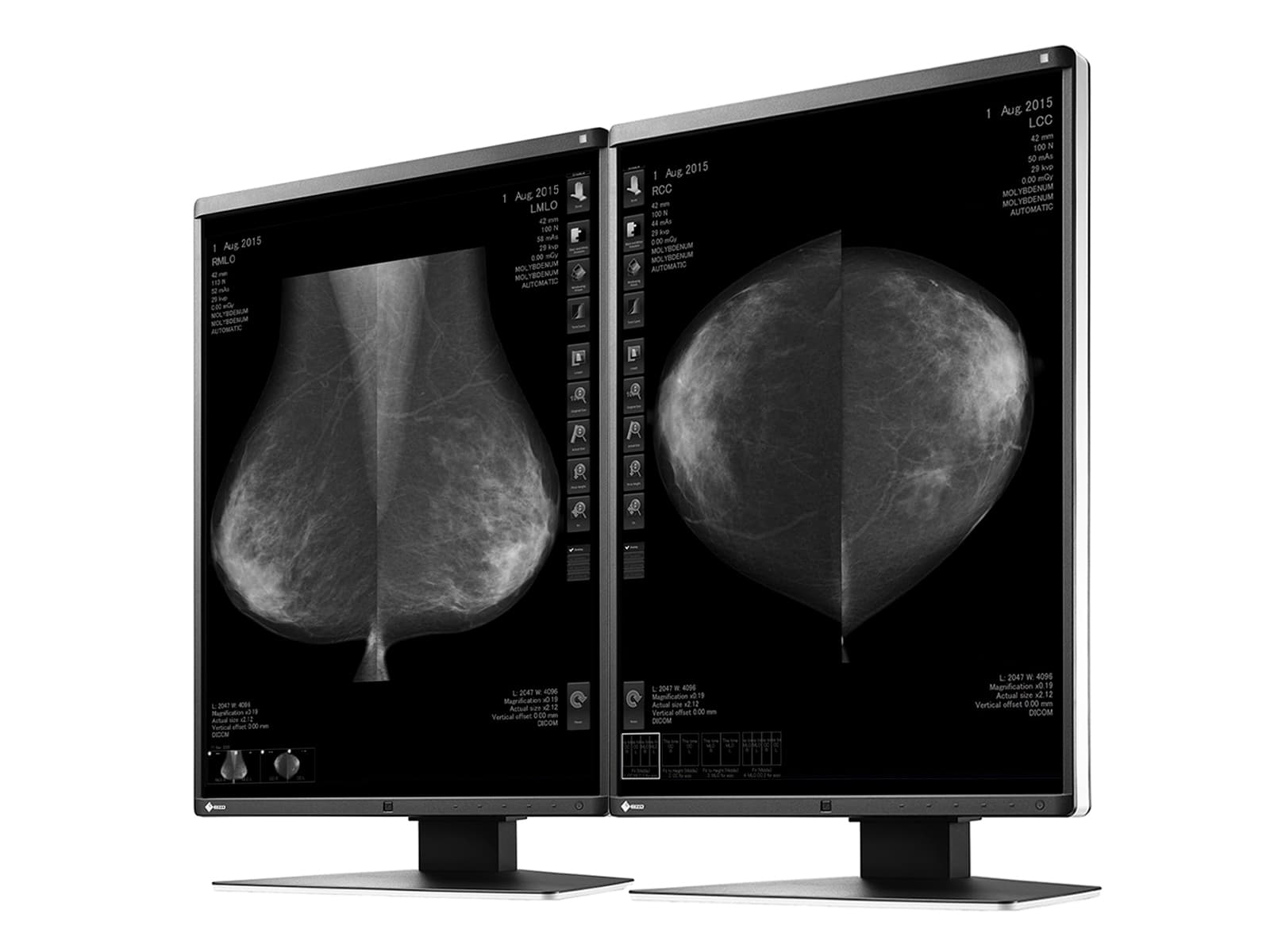 Moniteur d'imagerie mammaire Eizo RadiForce GX560 5MP 21" LED en niveaux de gris Mammo 3D-DBT (GX560-MD) Monitors.com
