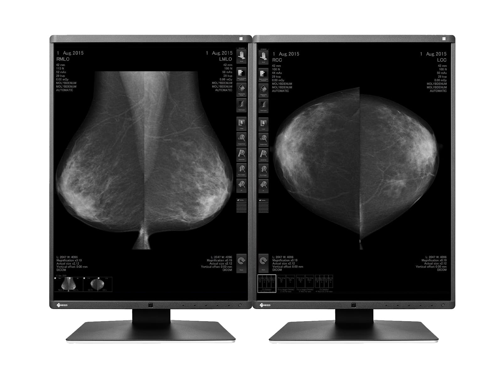 Moniteur d'imagerie mammaire Eizo RadiForce GX560 5MP 21" LED en niveaux de gris Mammo 3D-DBT (GX560-MD) Monitors.com