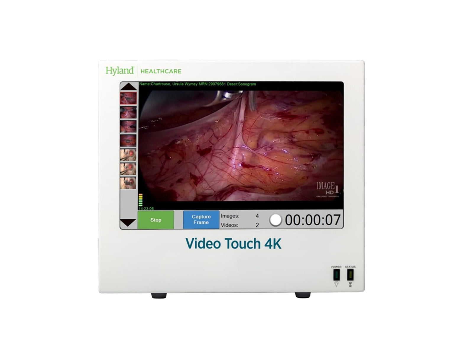 Hyland 4K Touch Medizinisches Videoaufnahmesystem (PER9472) Monitors.com