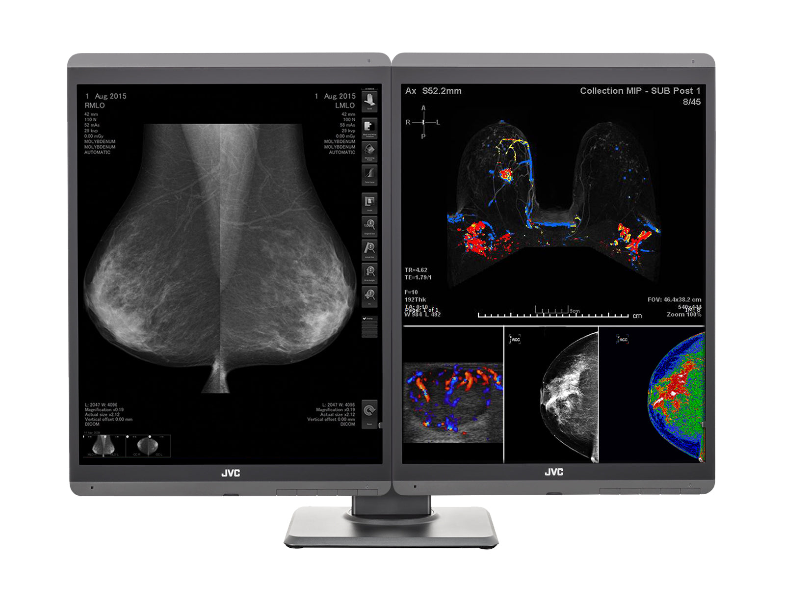 JVC Totoku CL-S500 5MP 21" Color LED Mammo 3D-DBT Breast Imaging Display (CL-S500) Monitors.com 