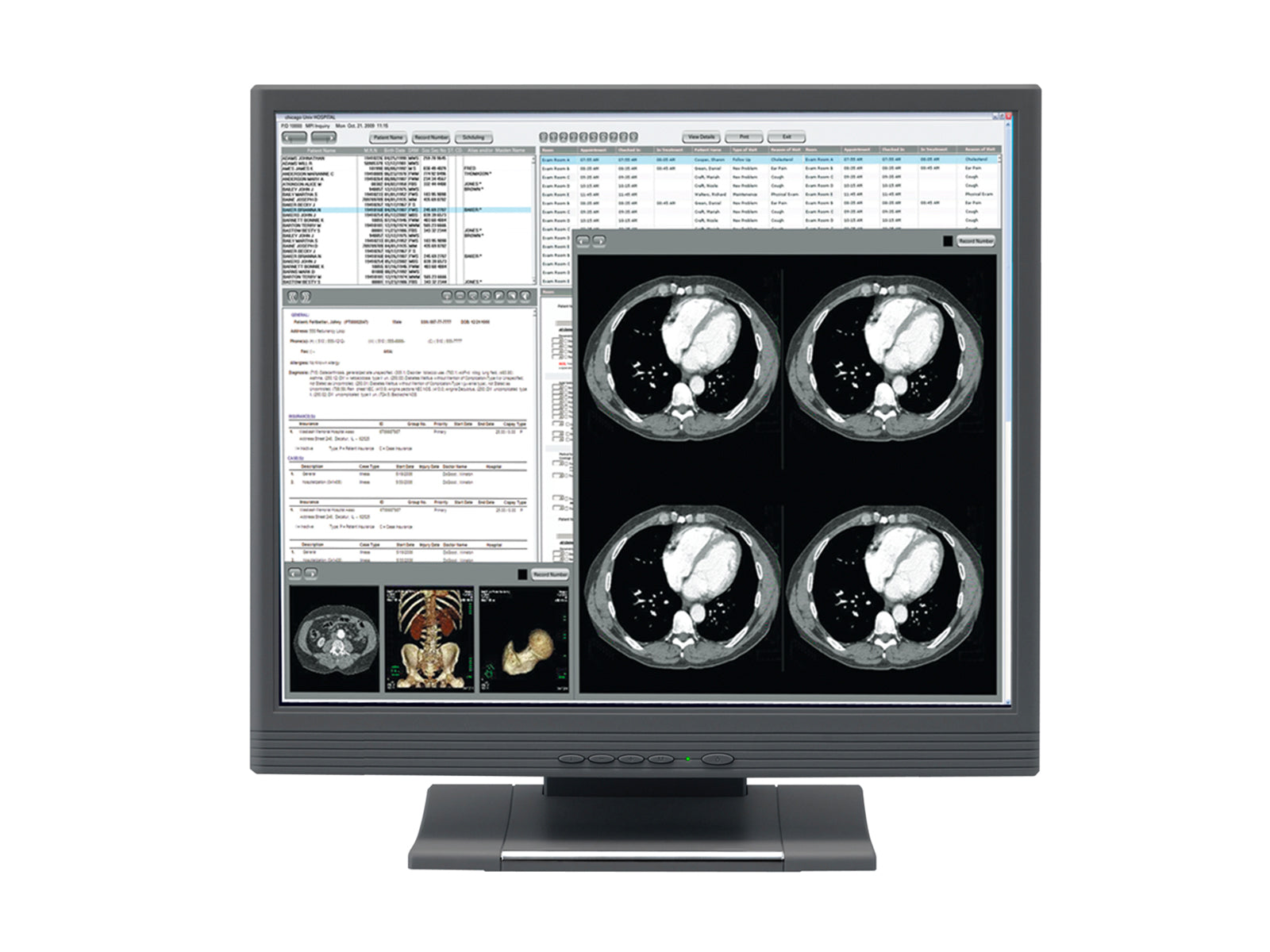 JVC CV932PJ 1MP 19" Touchscreen Color Clinical Review Display (CV932PJ) Monitors.com 